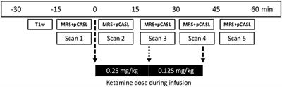 Glutamate Levels and Resting Cerebral Blood Flow in Anterior Cingulate Cortex Are Associated at Rest and Immediately Following Infusion of S-Ketamine in Healthy Volunteers